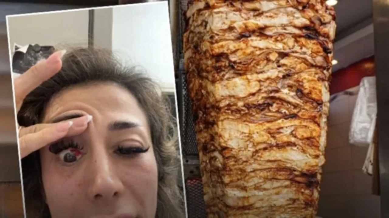 Tavuk dönerden gözü bu hale geldi!