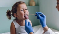 Yaz aylarında "Molluscum contagiosum" enfeksiyonuna dikkat!