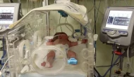 Asel bebek ihmalden yandı!
