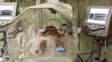 Asel bebek ihmalden yandı!