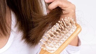 Modern yaşam saç döküyor