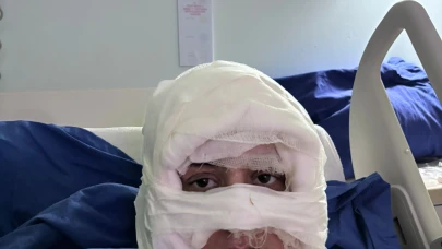 Kadıköy'de üzerine kolonya döktüğü kadını yakan sanık ilk kez hakim karşısına çıktı