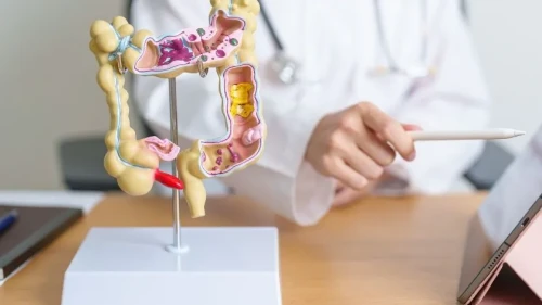 Kolitin tedavisi mümkün